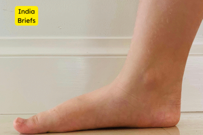 बच्चों में Flat Foot: कारण, लक्षण और समाधान