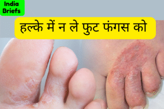 फुट फंगस
