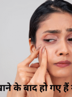 pimple after eating mango