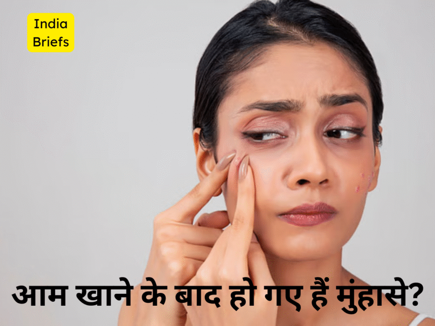 pimple after eating mango
